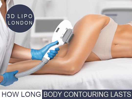Image depicting the longevity of body contouring results, highlighting factors that influence duration and effectiveness.